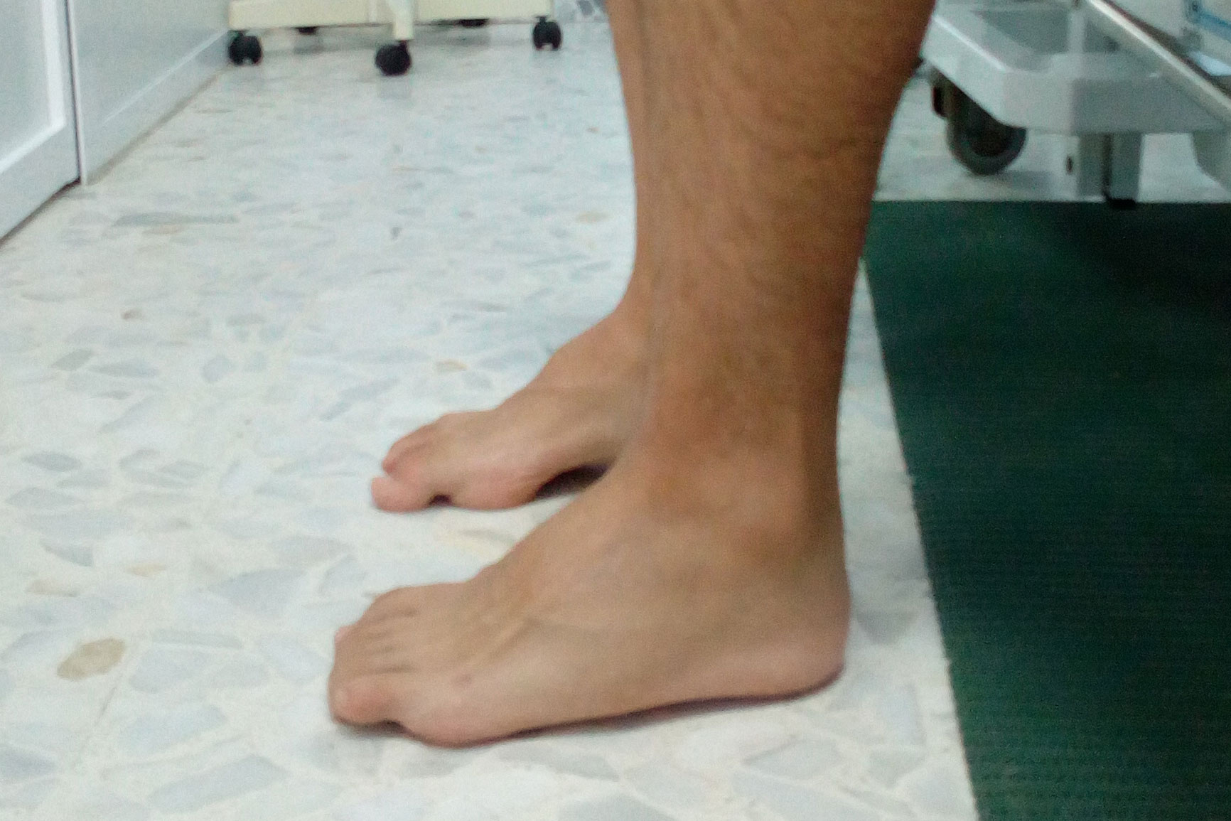 Reeducación Postural y Control Motor Fisin Fisioterapia